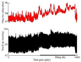 a b Hình 1 12 Test biến thiên nhịp tim và huyết áp khi thay đổi tư thế a Đáp 1