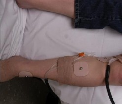 Hình 1 15 Vỏ bao chuyên biệt gắn kèm ống để tiêm acetylcholine Nguồn Novak 2011 95 6