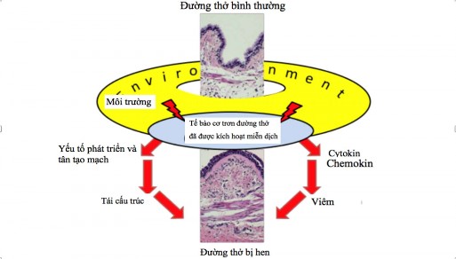 Hình 1 2 Sơ đồ về giả thuyết cơ chế gây tái cấu trúc đường thở Nguồn 1