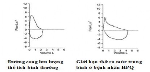 Hình 2 1 Đường cong lưu lượng thể tích Nguồn Miller M R et al 2005 101 Phân chia 1