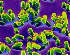 Trực khuẩn dịch hạch Brucella Do sự ổn định tương đối hình thể và kích 11