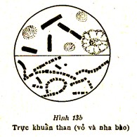 Xếp thành hình bó củi như trực khuẩn lao Có thể cong như hình dấu phẩy gọi 7