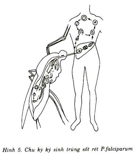 CÂU HỎI LƯỢNG GIÁ 1 Chẩn đoán bệnh sốt rét cần xét nghiệm A Các chất dịch 1