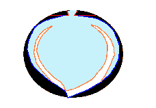 Hình 4 4 Tỉa quả đào Tạo núm cho quả đào đào Sửa hình tròn thuôn nhọn lại 4