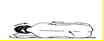 Hình 49 1 Tư thế nằm và vị trí chọc dịch não tuỷ ở lưng Chuẩn bị bệnh 1