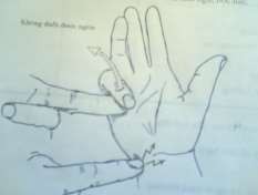 Hình 49 7 Ấn vào bao hoạt dịch đau chói 2 1 Khi viêm tấy giai đoạn đầu chưa có 9