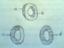 Hình 50 3 Hình xương tù với các lỗ dò Hình 50 4 Các dạng xương tù a b Tù một 3