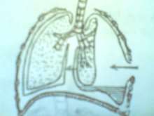 Thở vào Thở ra Hình 52 3 Rối loạn sinh lý trong vết thương ngực mở 3 Biến 3