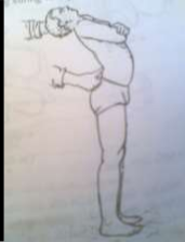 Hình 55 6 Khám tìm điểm đau Hình 55 7 Các vị trí loét thường gặp Chấn thương 1