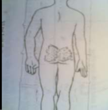 Hình 55 6 Khám tìm điểm đau Hình 55 7 Các vị trí loét thường gặp Chấn thương 2