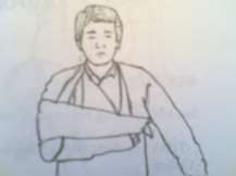 Hình 60 2 Hội chứng Volkman Hình 60 3 Bất động đúng nguyên tắc 5 Xử trí ở 5