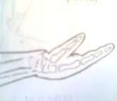 Hình 61 3 Ấn vào ổ gãy đa Hình 61 4 Hình lưng đĩa Hình 61 5 Hình lưỡi lê 3 2 4 X 3