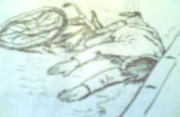 Hình 62 1 Tai nạn giao thông Hình 62 2 Mê sau chấn thương 1 Triệu chứng và các 6