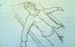 Hình 62 1 Tai nạn giao thông Hình 62 2 Mê sau chấn thương 1 Triệu chứng và các 7