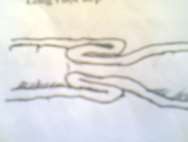 Hình 66 1 Lồng ruột đơn Hình 66 2 Lồng manh hồi tràng Hình 66 3 Lồng ruột kép 1 8