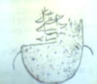 Hình 69 1 Dạ dày hình chậu 1 3 1 Các khối u lành tính dạ dày tá tràng U lao ở 10