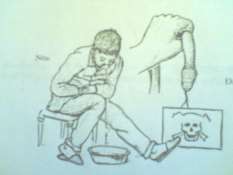 Hình 67 3 Thoát vị nghẹt phải mổ cấp cứu 3 2 Triệu chứng thực thể 3 2 1 Nhìn 3