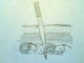 Hình 70 3 Vết thương thành bụng Hình 70 4 Vết thương thấu bụng 2 1 Vết thương 3