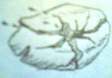 Hình 71 1 Vỡ lách gây chảy máu Hội chứng thủng tạng rỗng Bệnh nhân đau lan 4