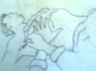 Hình 72 3 Tìm dấu hiệu rung gan Hình 72 4 Phương pháp nắn gan 3 3 1 Gan to Cần khám 2