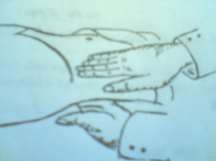 Hình 75 3 Cách làm dấu hiệu chạm thận và bập bềnh thận 4 3 Triệu chứng cận 3