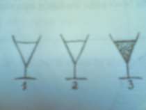 Hình 77 3 Nghiệm pháp 3 cốc Hình 77 4 Sỏi bàng quang đái máu cuối bãi 3 3 Triệu 3