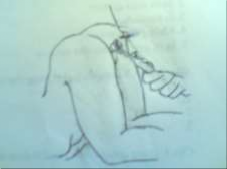 Hình 82 7 Soi hậu môn 1 3 Khám toàn thân Cần khám các cơ quan như Gan lách đo 10