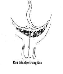 Hình 89 1 Vị trí rau tiền đạo 3 Nguyên nhân Chưa rõ ràng Một số yếu tố 2