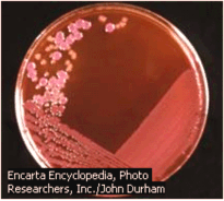 a b c Hình 6 2 a Các khuẩn lạc E coli sinh trưởng trên đĩa thạch agar b Hai dạng 1