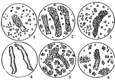 T ế bào th ượ ng bì b ể th ậ n và ố ng th ậ n to hơn tế bào thượng bì 4