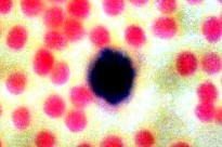 Nhân to hình bầu dục hình hạt đậu hình quả thận rìa không đều bắt màu tím 5