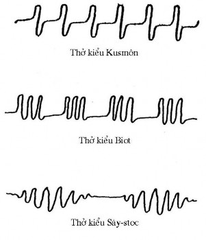 Thở thể ngực lúc gia súc thở thành ngực hoạt động rõ còn thành bụng hoạt 1