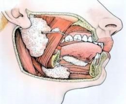 Hình 1 1 Tuyến nước bọt mang tai 1 1 2 Thành phần hoá học Nước bọt chứa 99 5 1