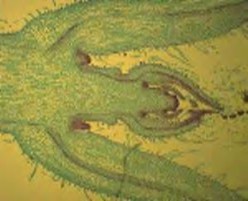 5 Trong hình của ổ túi bào tử mũi tên chỉ mức bội thể nào của cấu trúc a 7