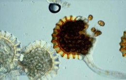 7 Mũi tên trong hình chỉ a Sợi mô cứng b Cấu trúc ống rây c Cấu trúc mạch d 8