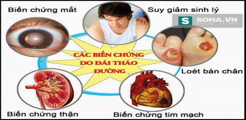 Cho học sinh xem ảnh về biến chứng đái tháo đường Nguyên nhân bị đai tháo 1