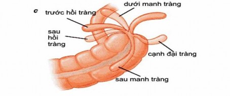 Hình 3 2 Vị trí của ruột thừa VI Điều trị 6 1 Viêm ruột thừa chưa có biến 1