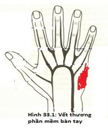 3 2 Theo hình thái tổn thương nguyên nh n  Vết xước da tổn thương lớp 1