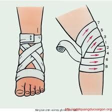 Hình 33 2 Băng vết Hình 33 3 Rửa và băng vết TỰ LƯƠNG GIÁ 1 Đặc điểm vết 2