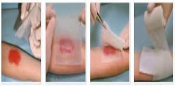 Hình 33 2 Băng vết Hình 33 3 Rửa và băng vết TỰ LƯƠNG GIÁ 1 Đặc điểm vết 3