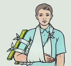 Hình 8 2 Cố định vào th n bằng băng tam giác Hình 8 3 Cố định bằng nẹp 5 2 2 7