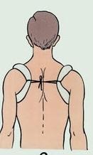 Hình 8 10 Cố định gãy xương 5 2 7 Gãy xương sườn Nhanh chóng băng vết thương 1