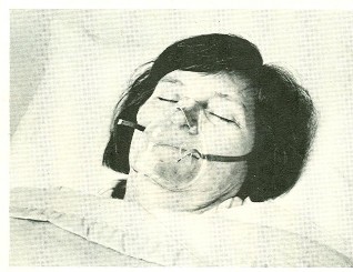 Thở ôxy qua mặt nạ Điều dưỡng rửa tay Kiểm tra lại dụng cụ và mang đến 1