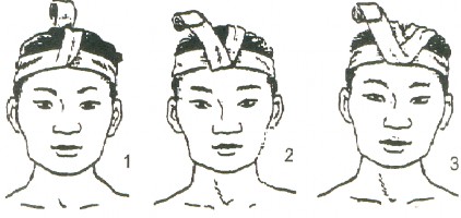 Hình Băng vòng gập lại 1 4 Ứng dụng các kiểu băng cơ bản để băng các vết 3