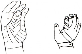 Hình Băng một ngón Băng kín 5 ngón Băng 2 vòng ở cổ tay vòng khóa 5