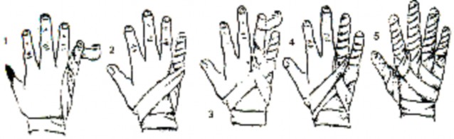 Hình Băng kín 5 ngón Bàn tay Mu và lòng bàn tay Thứ tự cũng như băng kín 5 ngón 1