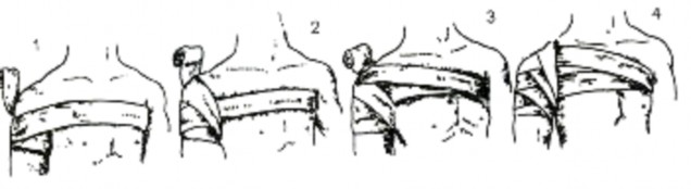 Hình Băng vai Bàn chân Bàn chân để hở gót Băng gót chân Băng 2 vòng khóa từ 4