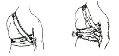 Hình Băng vú Băng một bên vú phải Băng 2 vòng tròn ngay dưới vú kéo dải băng 5