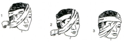 Hình Băng một mắt Băng hai mắt Băng 2 vòng quanh đầu qua trán và chẩm làm vòng 7