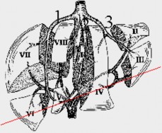 Hình 1 5 Lớp cắt qua phần thấp của gan qua các HPT III IVb V VI 11 6